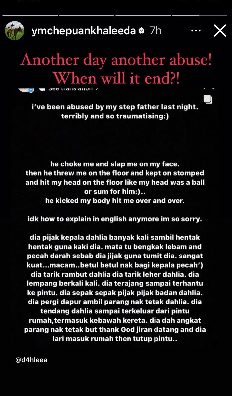 少女被虐打柔王妃也愤怒！警方证实：继父踩她头部