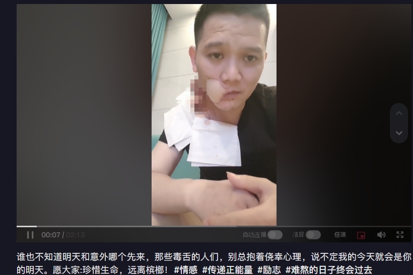 才切左脸又长肿块  36岁男歌手口腔癌病逝