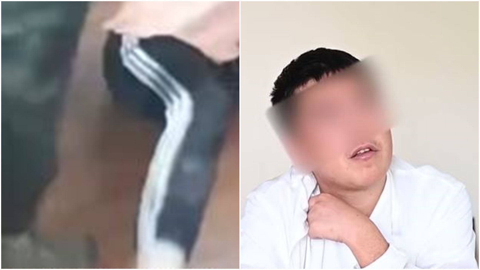 湖北男忆惨况:每日被揍2、3小时 边打边给我爸直播