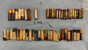 爱尔兰66岁老妇吞下55颗电池 胃下垂到耻骨附近