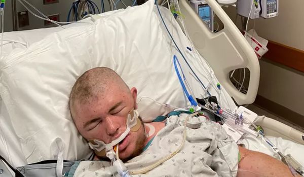 误砍蜂巢被狂螫2万下 男子体内还有30只