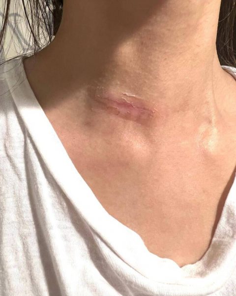  34岁女星证实罹癌 泪崩问：为什么是我