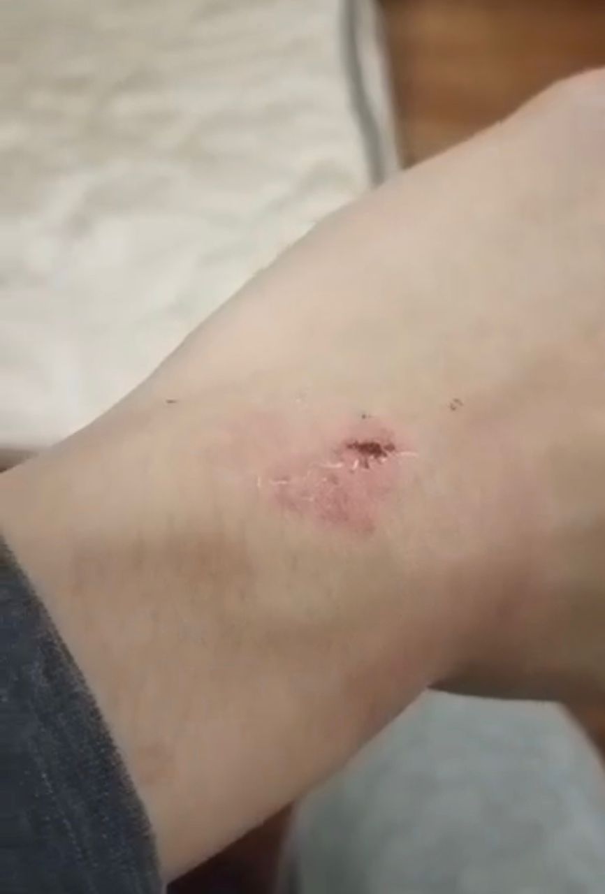 大都会（版2头）/热线投诉-被不法集团利用进行诈骗