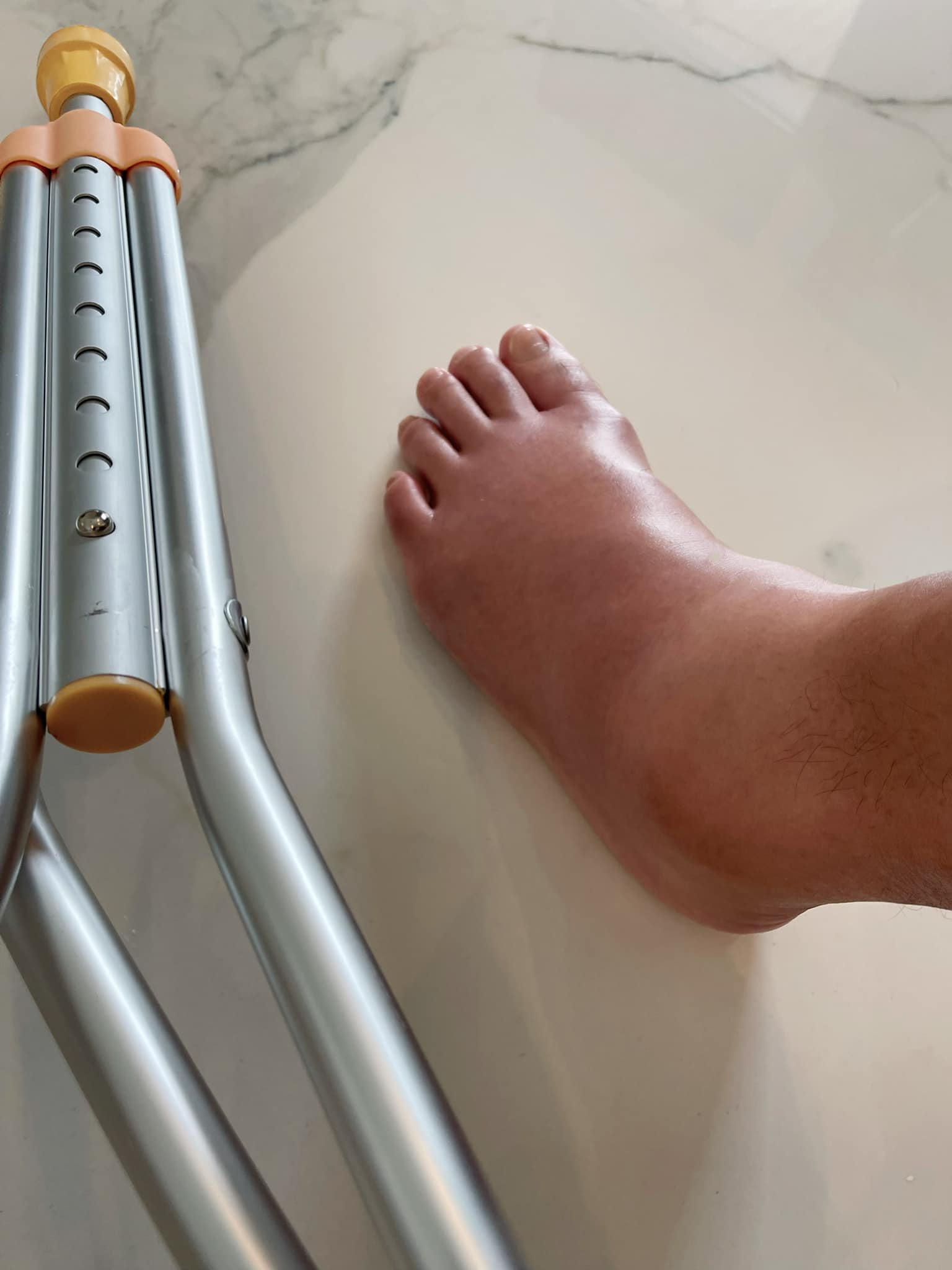 左脚“肿成猪腿”  李铭顺抱憾缺席金钟奖