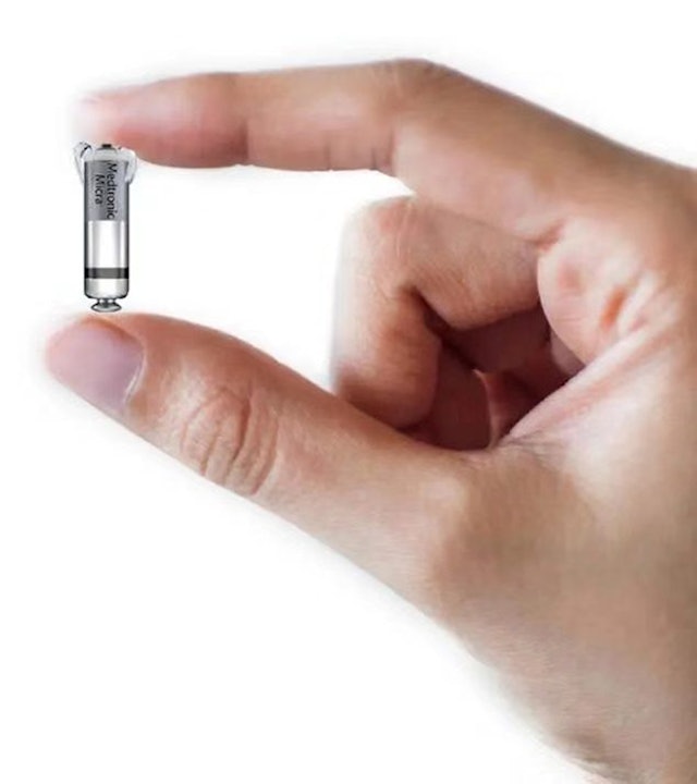 拼盘/全球体积最细心脏起搏器 上海八旬患者手术植入即日可下床