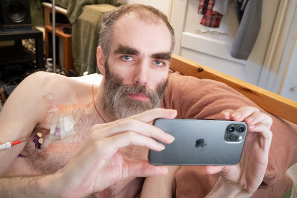 拼盘/罹严重免疫性疾病加州男 自拍《死著活》获金奖