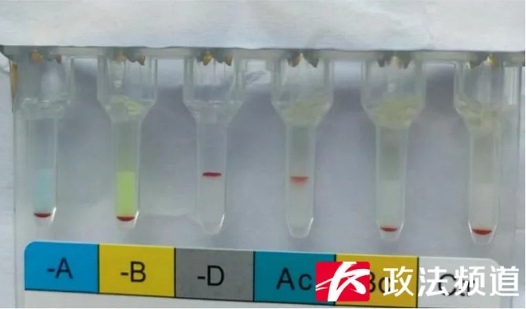 拼盘/超级罕见!长沙发现一例“恐龙血” 十几万分之一