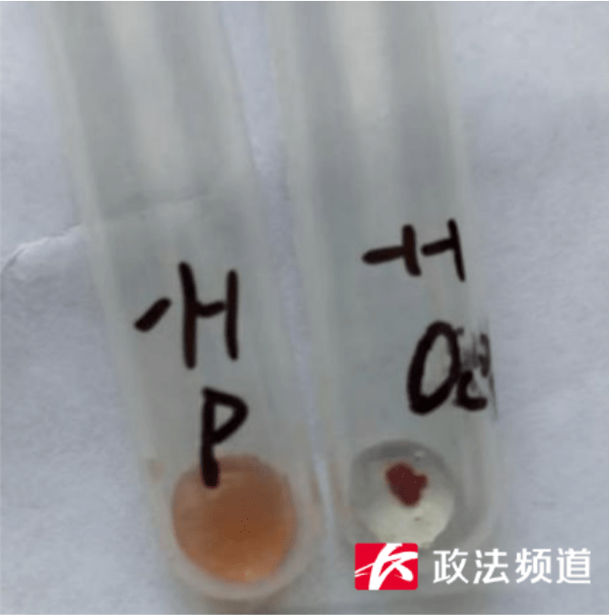 拼盘/超级罕见!长沙发现一例“恐龙血” 十几万分之一
