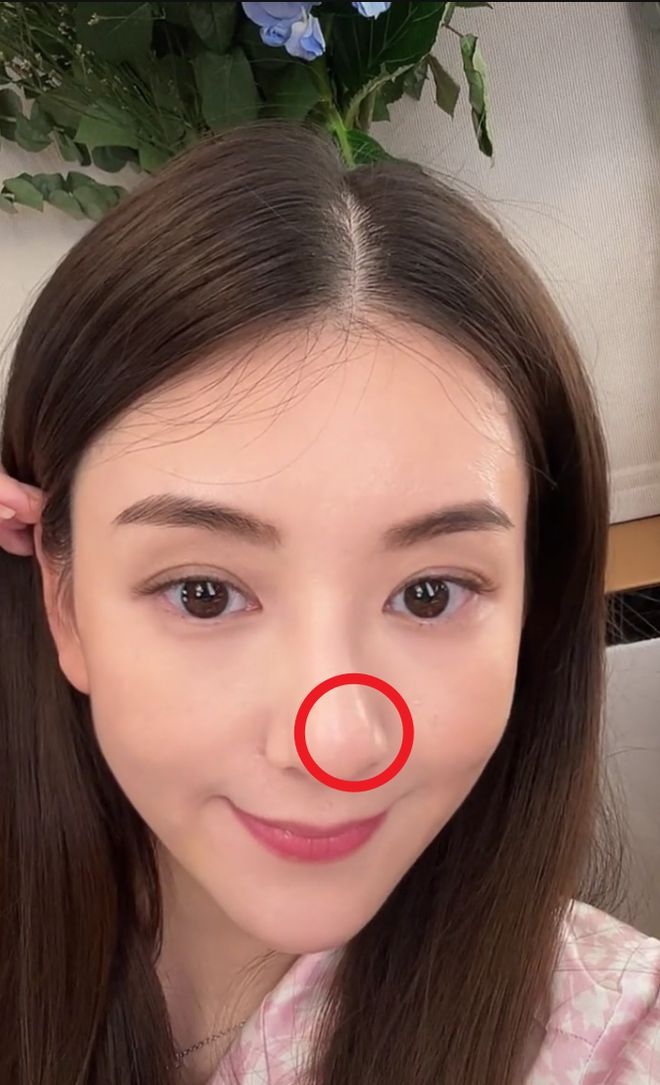 方媛误发私密视频 鼻子歪斜再惹整疑云