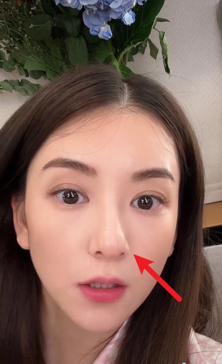 方媛误发私密视频 鼻子歪斜再惹整疑云