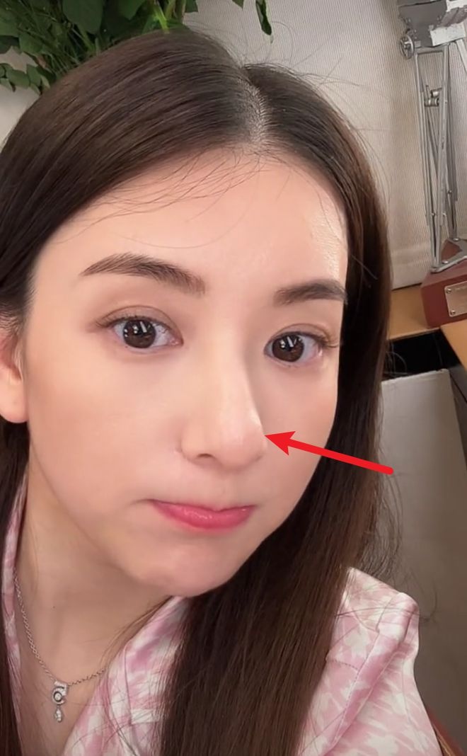 方媛误发私密视频 鼻子歪斜再惹整疑云