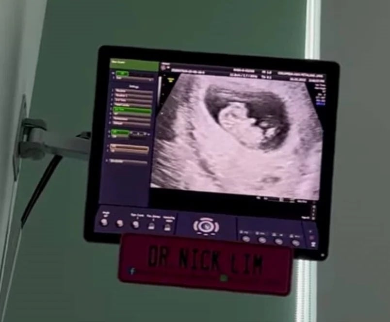 朱浩仁晒超音波照 官宣好人要变好爸爸