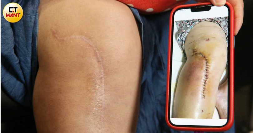 男偶像违停害女外送员骨裂   嚣张呛“撞我特斯拉还敢告”