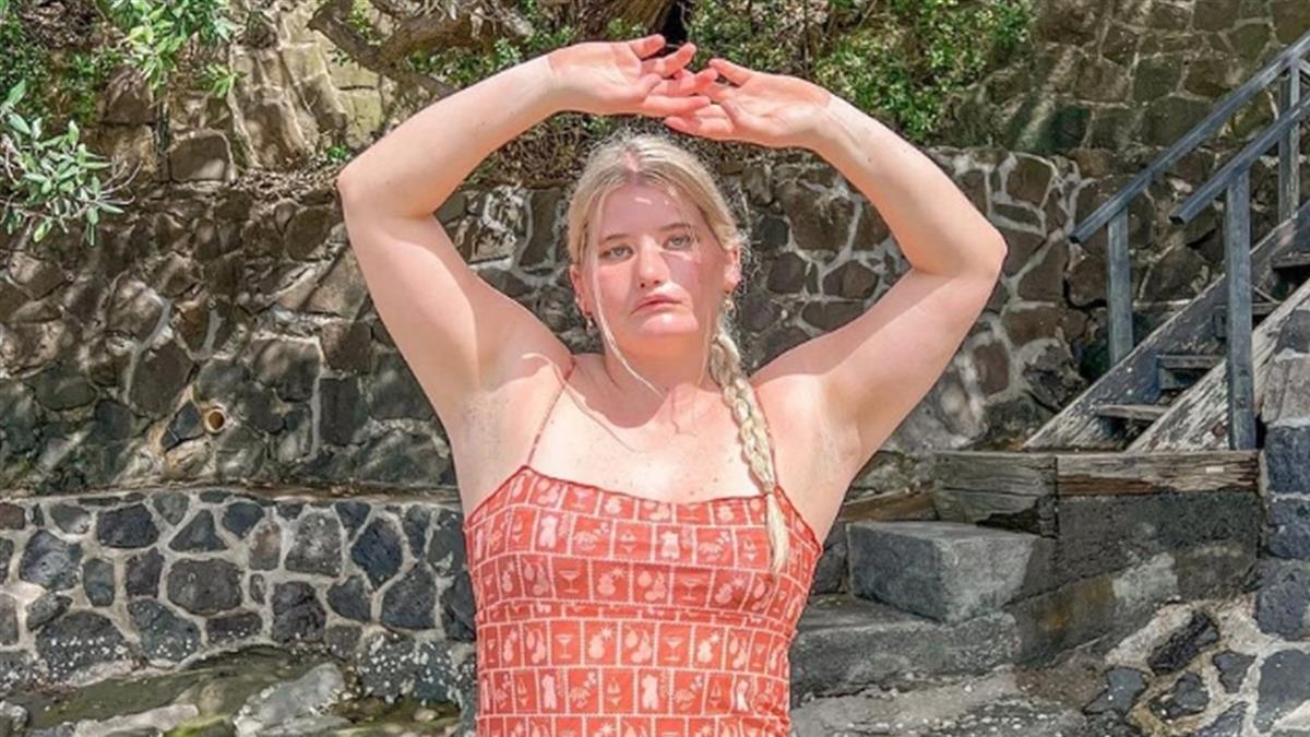 真的笑不出来!女模自幼患罕病「天生面瘫」饱受霸凌