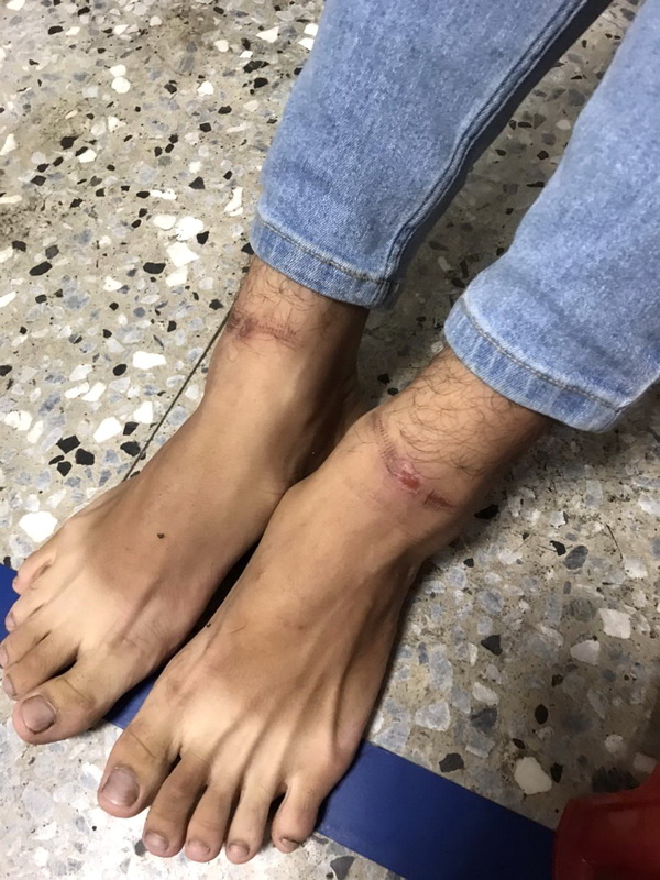 台湾惊现“柬埔寨式”勒索集团 26人堕求职陷阱遭禁锢虐打