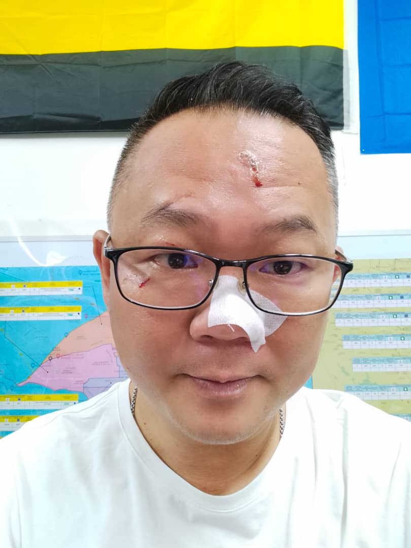 民主国运特辑/跌裂手骨 被狗咬 竹伤脸 患冠病 无阻候选人拜票拼劲可嘉