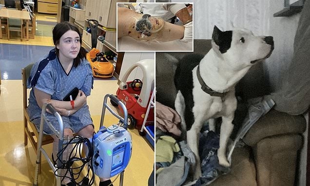 看世界/ 养8比特犬看家!爸妈目睹16岁女儿被爱犬撕咬 地上四散咬烂血肉