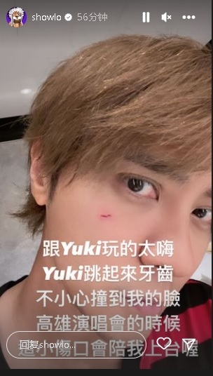 罗志祥开唱前夕“破相” 脸遭爱犬牙齿撞伤