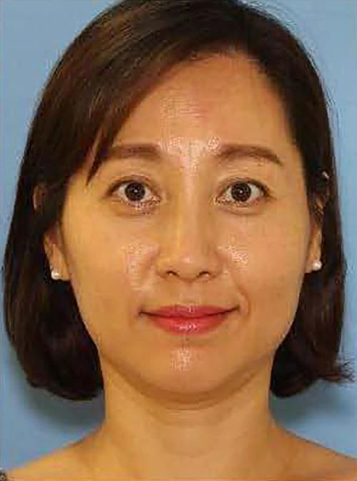 美妇被前夫活埋 曾用Apple Watch报警