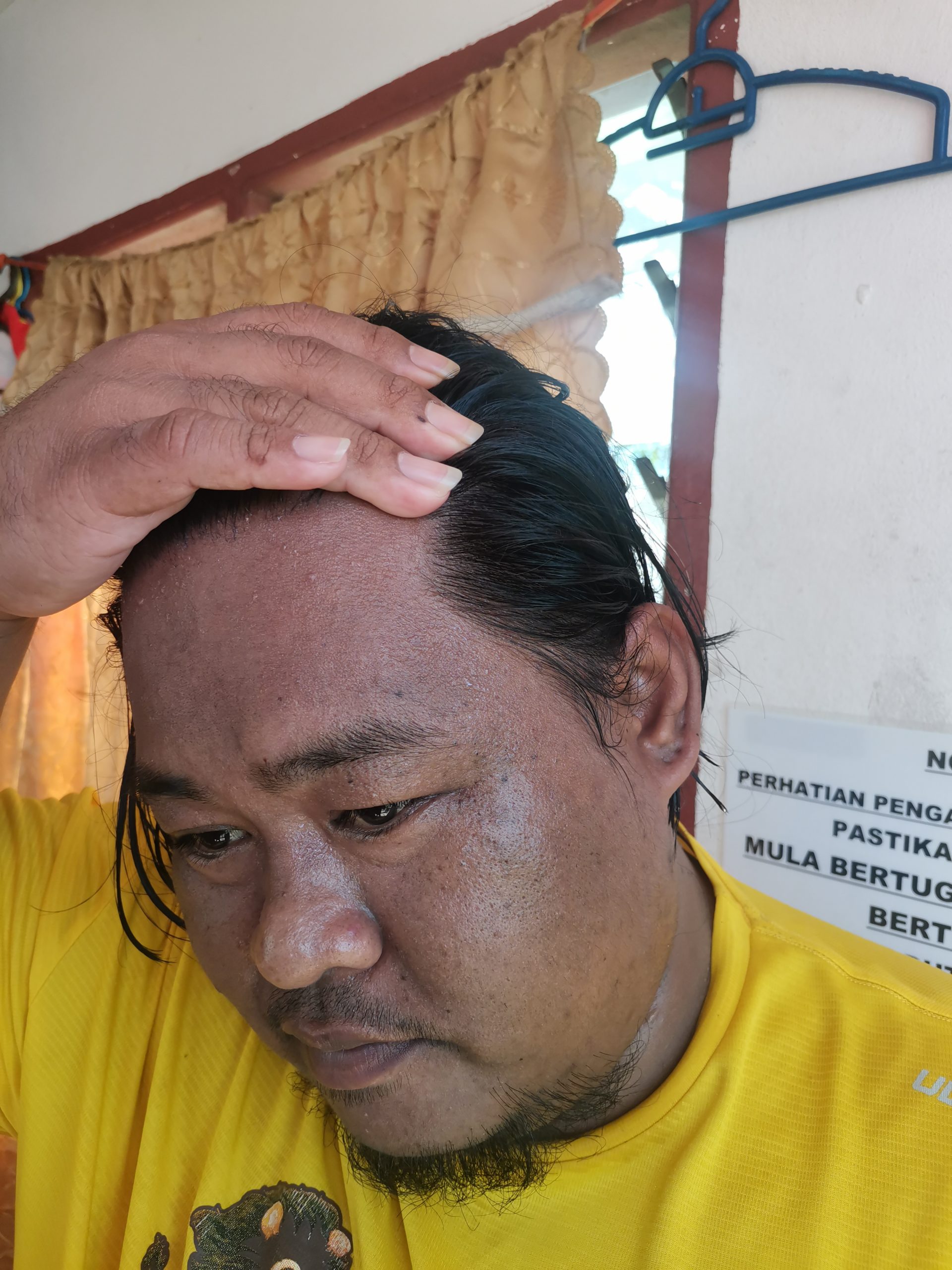 美里/公园发生黄蜂(又称虎头蜂)螫死人事件!