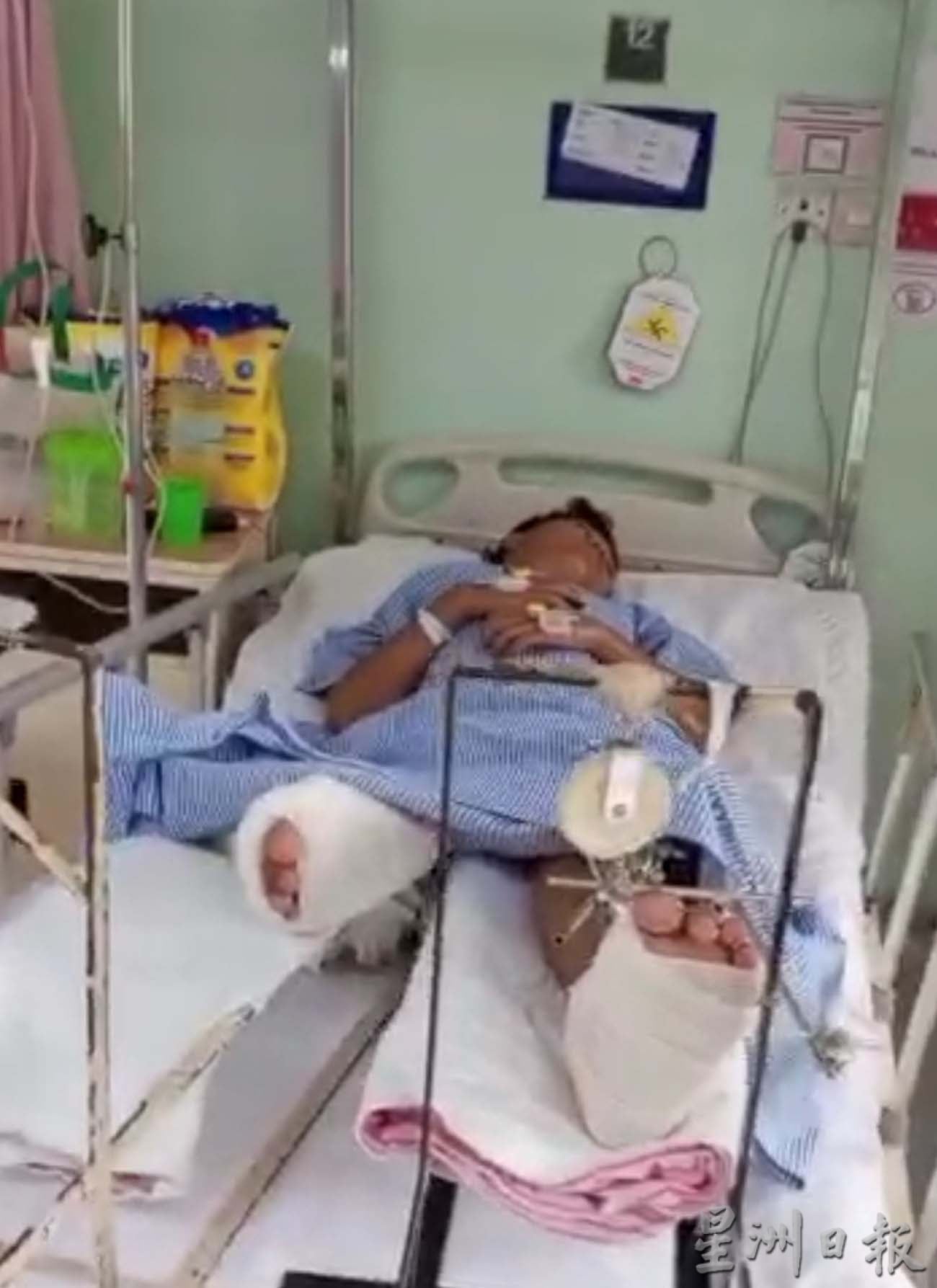 霹:黑白头/少年失足从6楼摔下4楼,急筹手术费保命