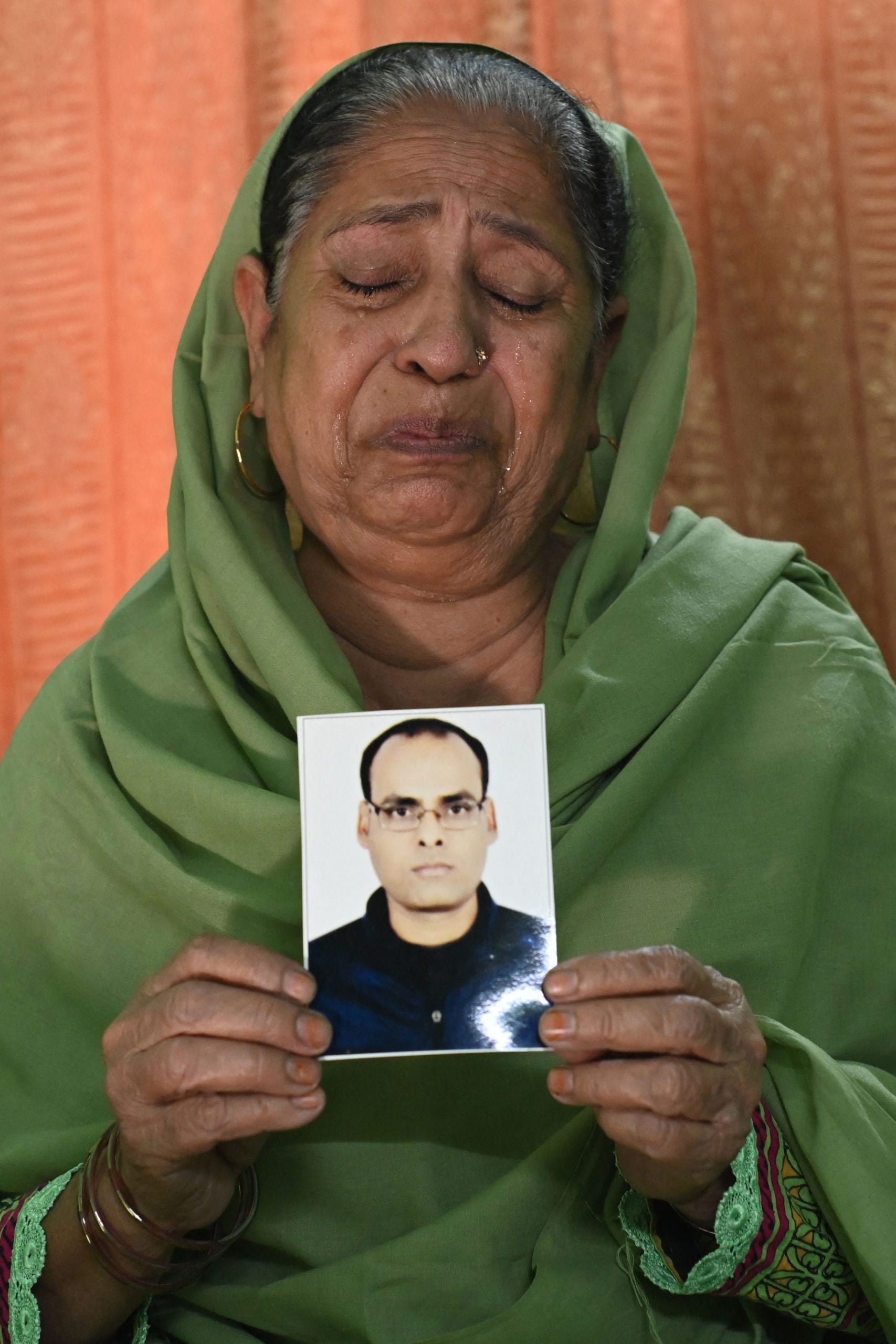 30岁秃头男想脱单 光顾廉价植发惨死  母亲：儿子全身肿胀冒黑疹