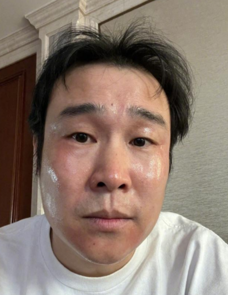 “哭株”、“学习株”、“放屁株”、“炫饭株”... 中国网民分享冠病奇葩感染症状