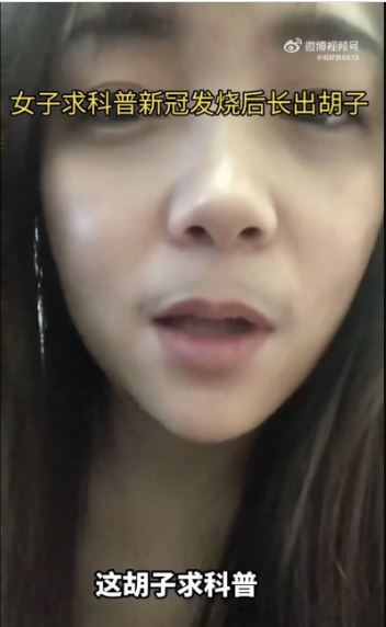 中女子确诊高烧「烧出八字胡」！