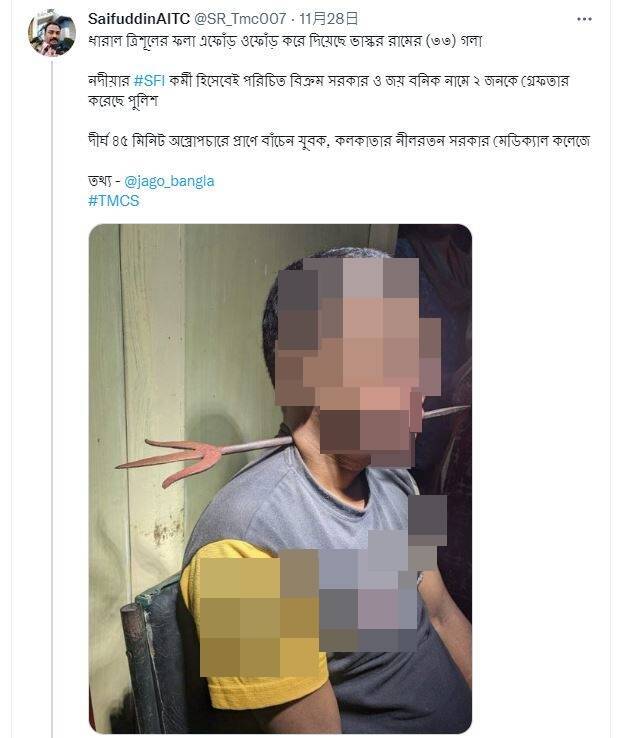 印度男脖插「30公分三叉戟」却不痛 淡定就医还能说话