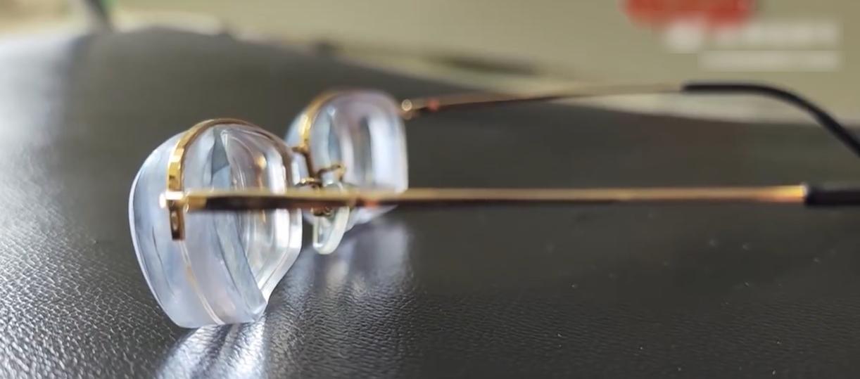 女子近视达3000度 被迫摘除眼球