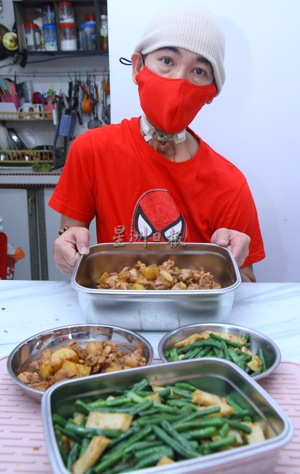 无舌癌症康复者谭嘉强 