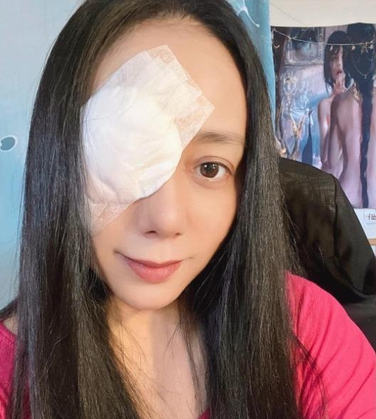 术后2个月眼仍未对齐 高慧君叹不要忽视健康