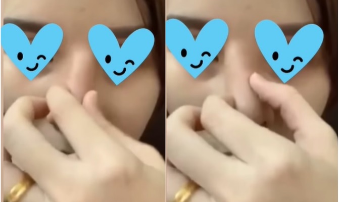 独家|无牌医美割双眼皮付RM6000 女子:“5次手术才修复!”