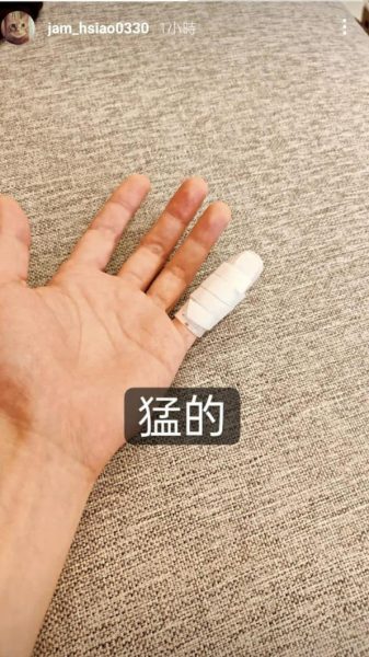 萧敬腾骨裂肌肉恐萎缩 坚持不打钢钉原因曝光