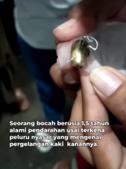 视频|与父母在家睡觉出事 岁半男童被流弹击中