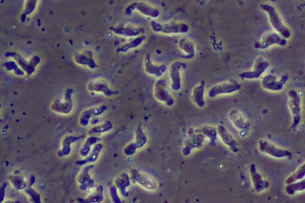 韩首起死亡案例！他感染变形虫脑袋遭啃食　曾长期滞留泰国