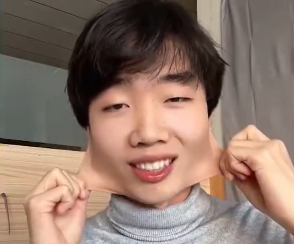 黑龙江男狂减132磅 脸皮可伸缩拉扯被指疑患罕见病