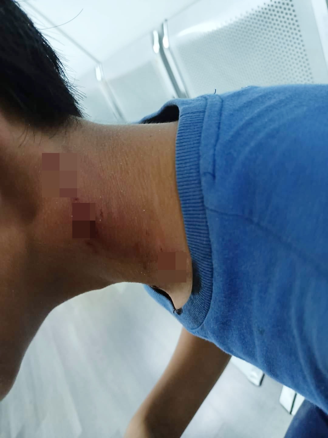 （全国版）邻居家犬咬伤男童，童父：邻居付20令吉打发