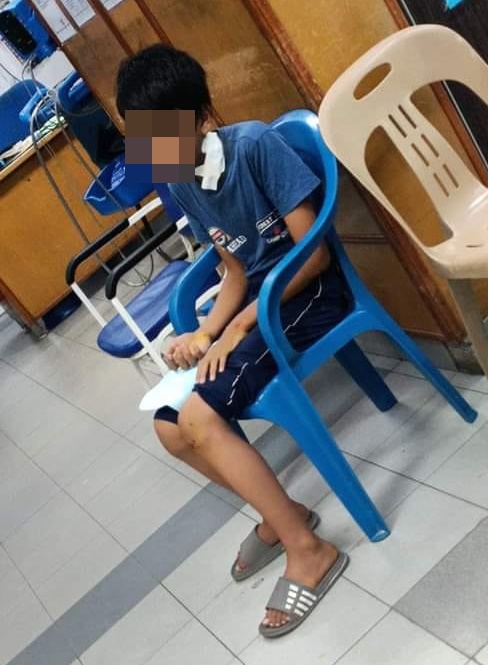 邻居家犬咬伤男童，童父：邻居付20令吉打发