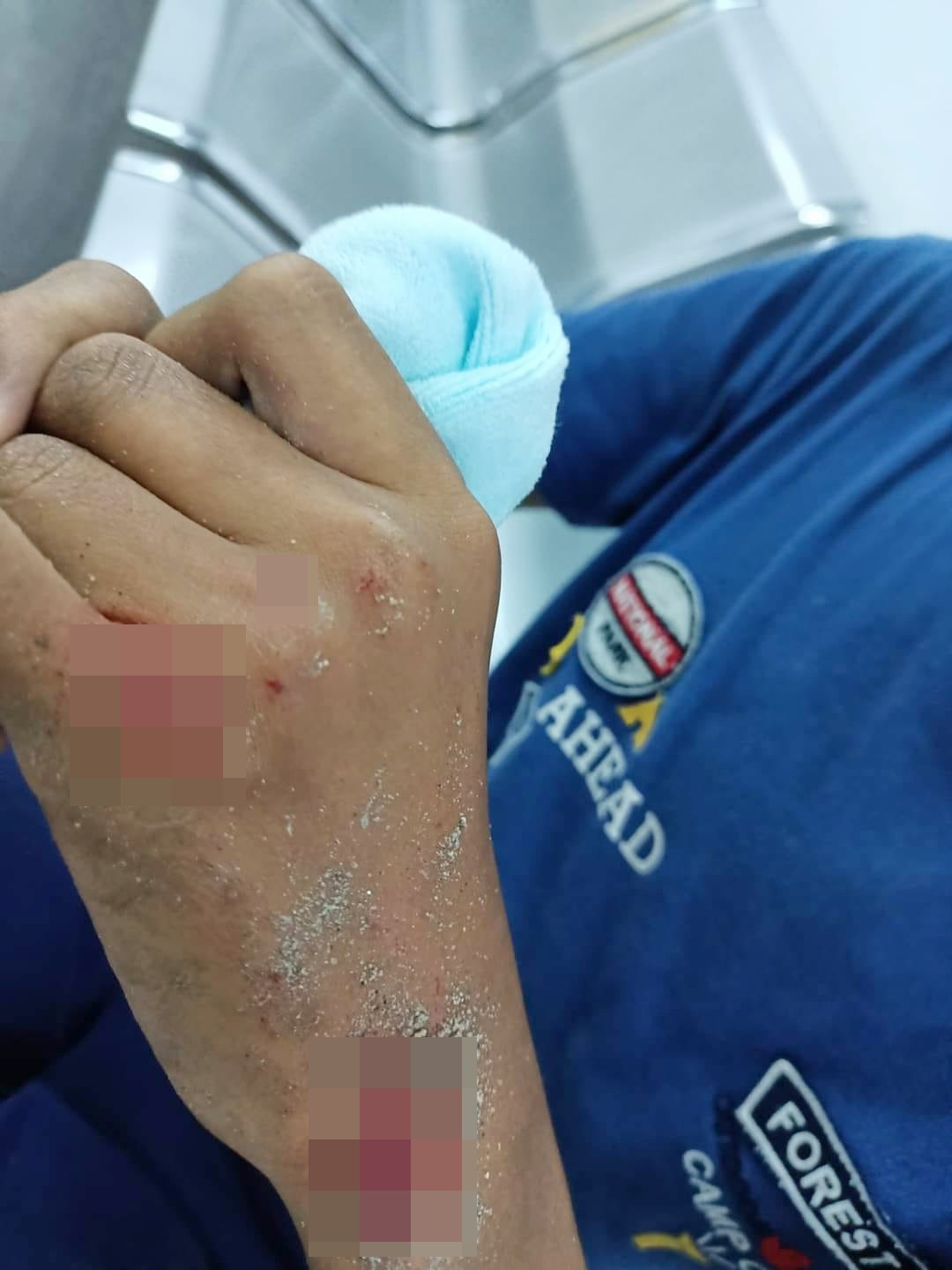 邻居家犬咬伤男童，童父：邻居付20令吉打发