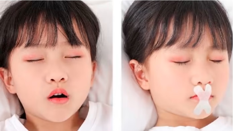 (已签发)柔:狮城二三事:网称熟睡儿嘴上贴胶布可矫正歪牙 狮城卫生科学局:正展开调查