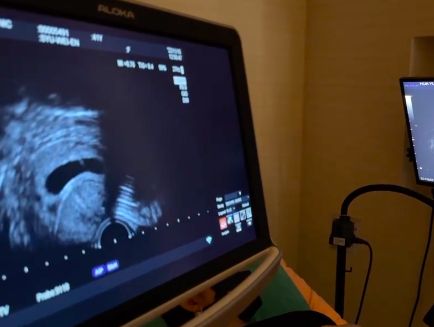 ​晒18秒宝宝心跳声  41岁许维恩宣布怀孕