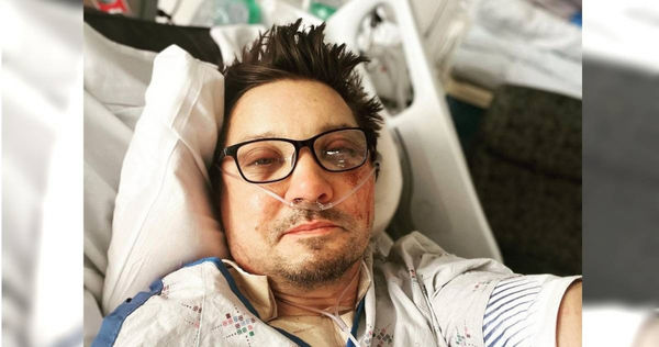 “鹰眼”伤势太严重不能再拍动作戏  复原时间恐长达2年