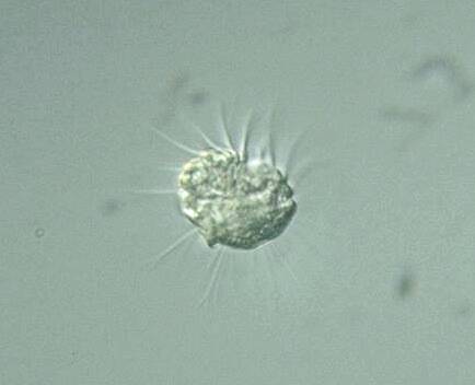 一物克一物! 科学家发现「专吃病毒」神奇微生物