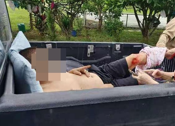 东:金马扬华裔男子遭不明人士砍伤