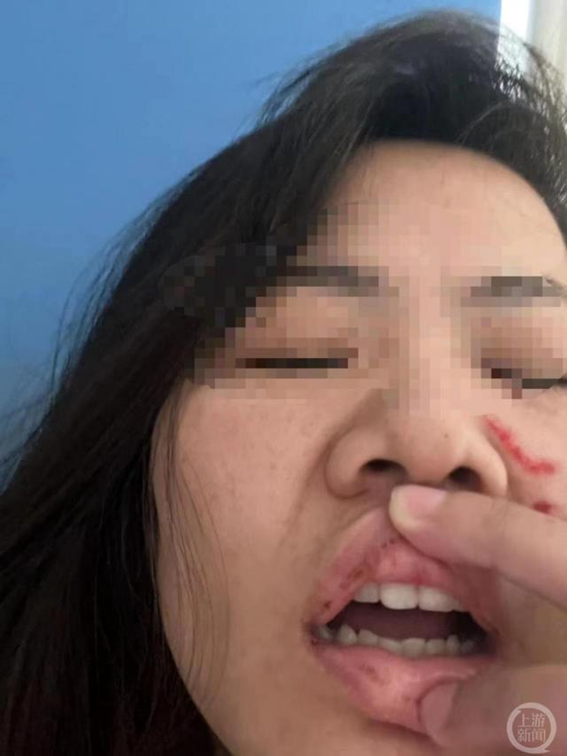 回乡过年拒绝相亲 河南母女被双双打到入院