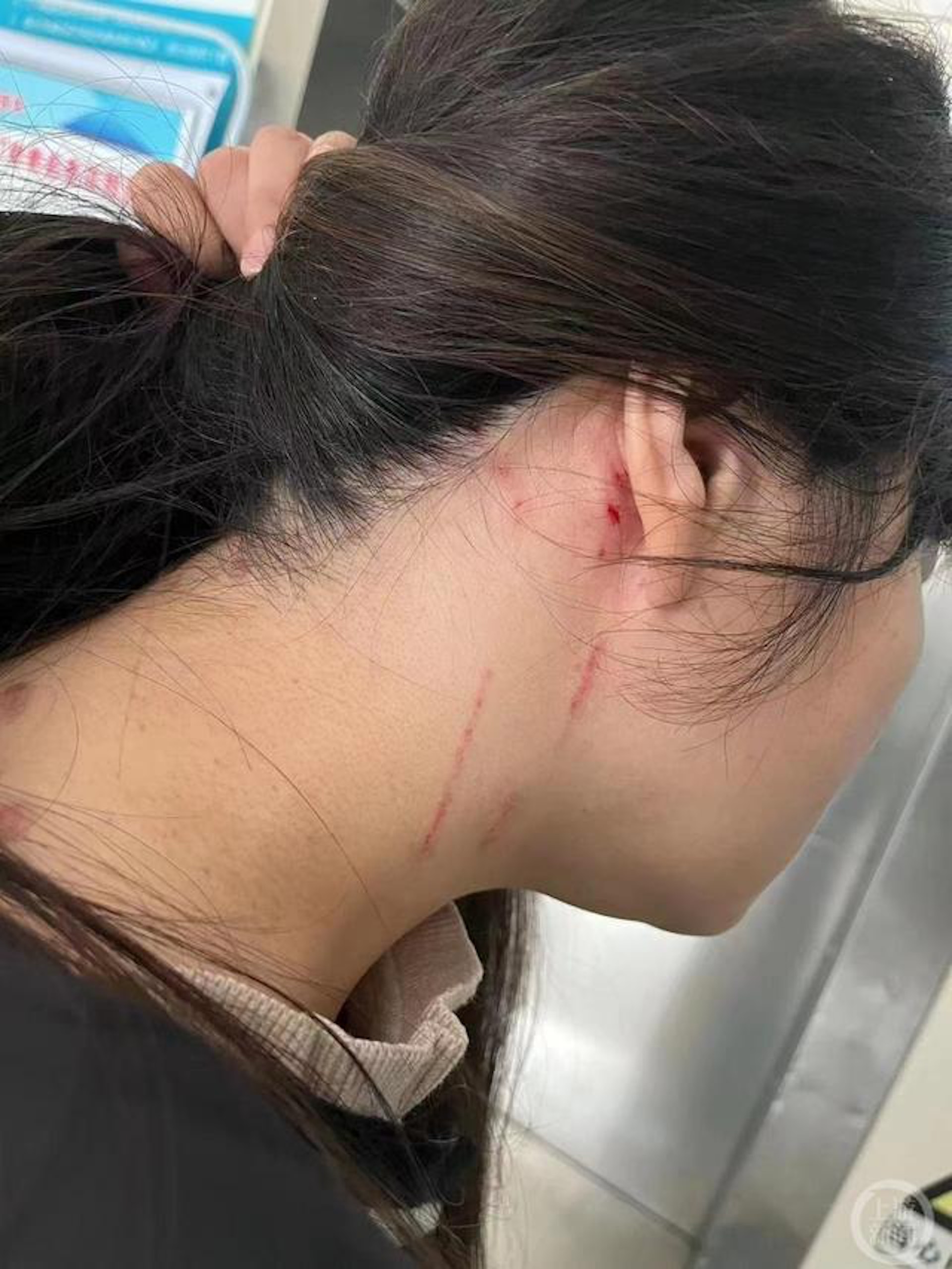 回乡过年拒绝相亲 河南母女被双双打到入院