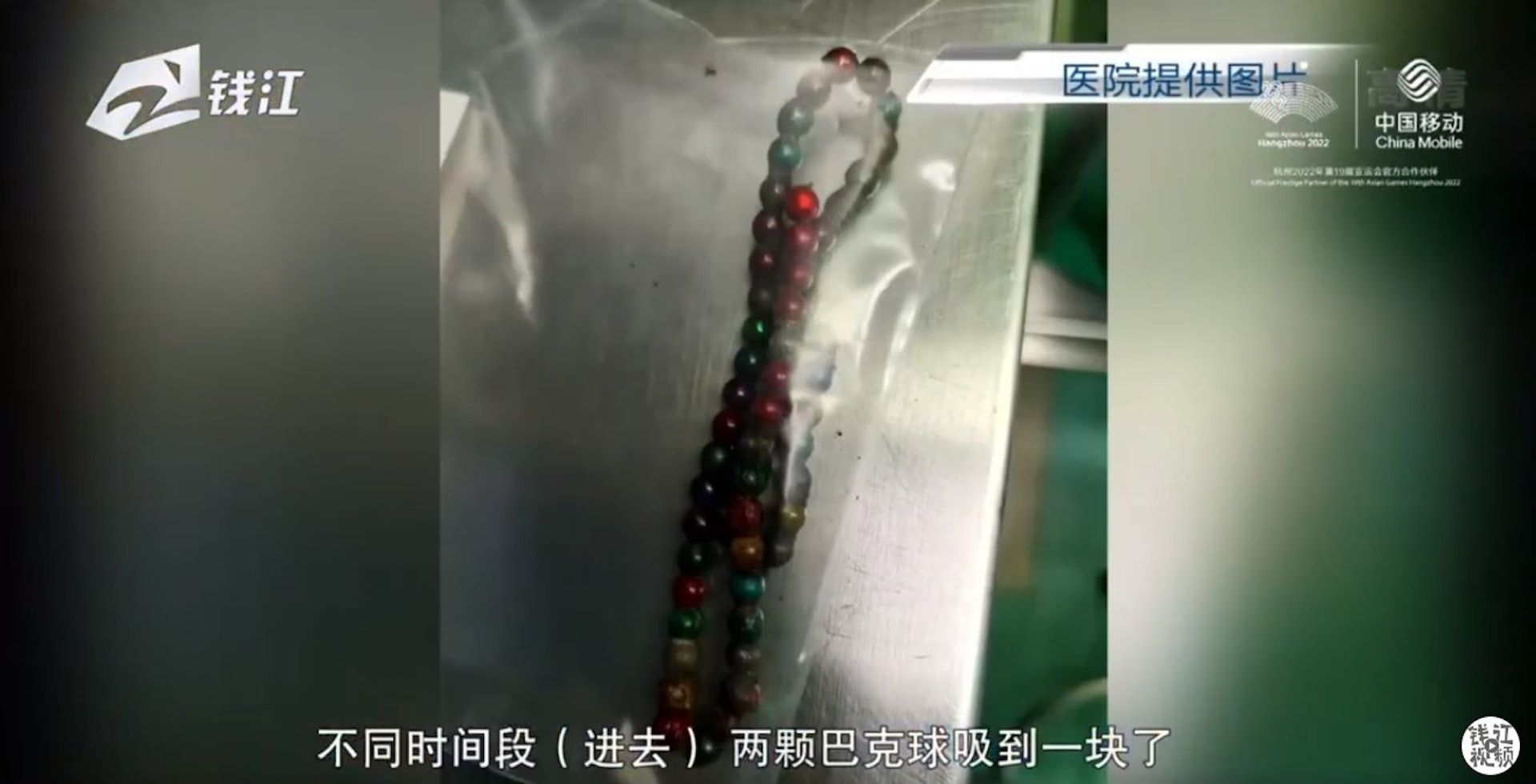 女童照X光惊见长串白点　医生摇头：一辈子毁了