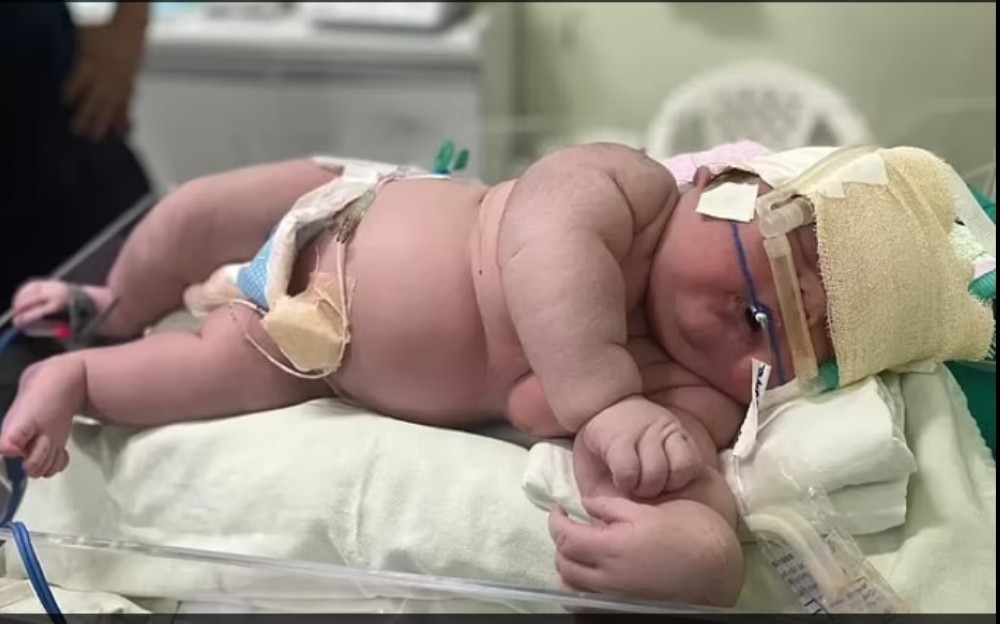 巨婴出世重达7.3公斤 体重相等两个新生婴儿