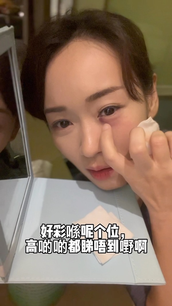 杨思琦“被掳”遭枪插眼 差1毫米就瞎！